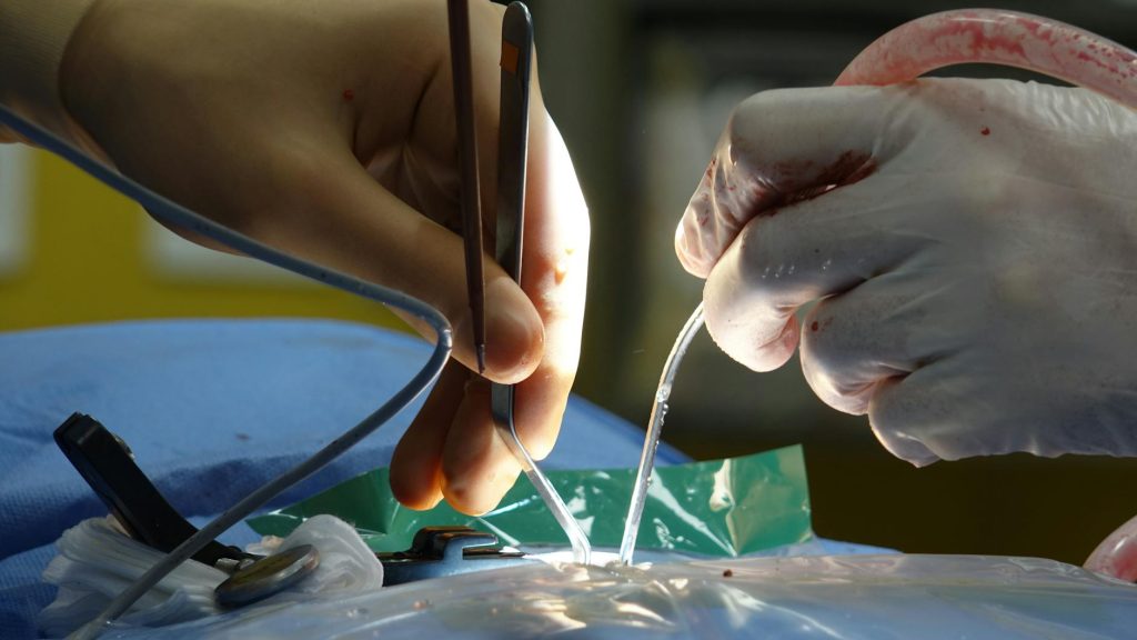 close up of surgical procedure in operating room